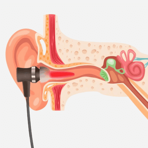 Hearlumi (official Retailer)